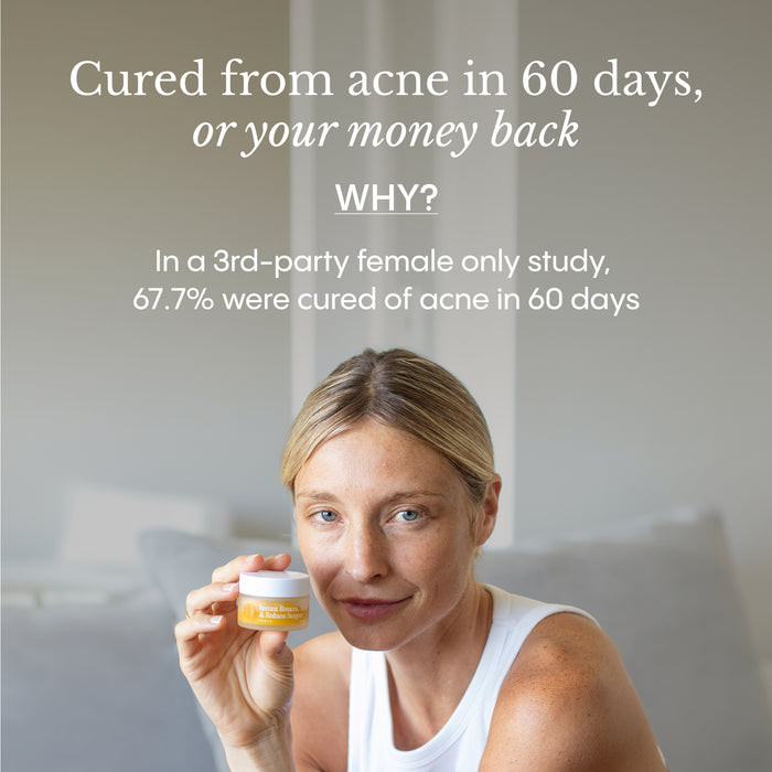 Before and after skin improvement with Frøya Organics Instant Rosacea, Acne & Redness Stopper