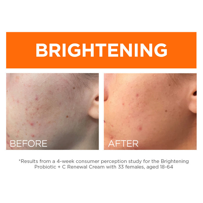 Brightening Probiotic + C Renewal Cream - Andalou Naturals US