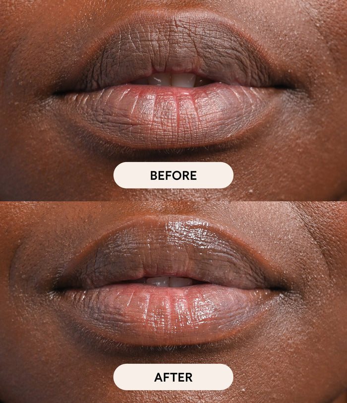 Before and after comparison of lips with a close-up view.