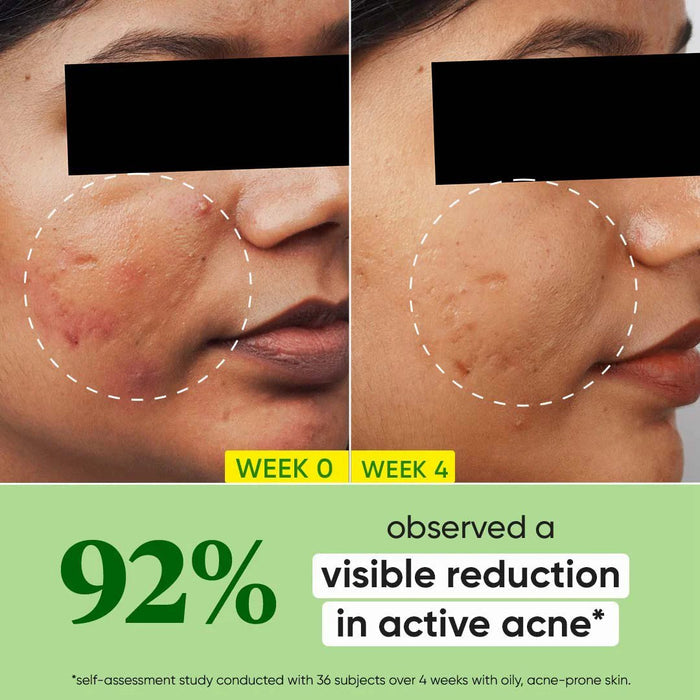Dot and Key Cica + 2% Salicylic Skin Clearing Face Serum 30ml