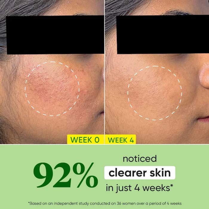 Dot and Key Cica Calming Oil Free Moisturizer for Acne Prone Skin 15ml