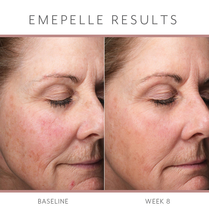 Emepelle Daily Serum 35ml