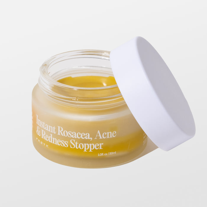 Frøya Organics Instant Rosacea, Acne & Redness Stopper in glass jar with lid – organic rosacea balm front view