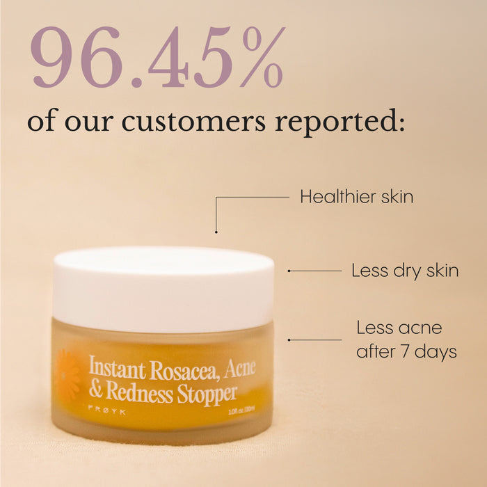 Customer showing results after using Frøya Organics Instant Rosacea, Acne & Redness Stopper
