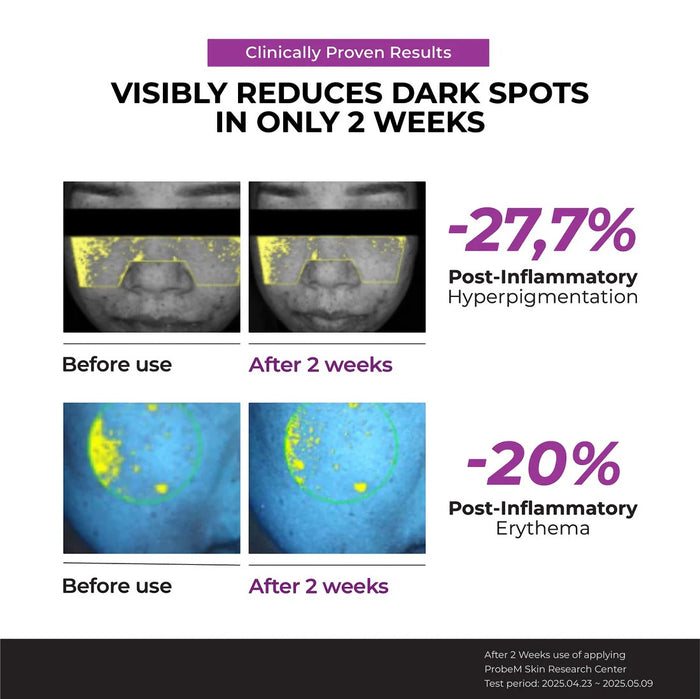 JUMISO Niacinamide 20 Serum - Dark Spot Correcting clinical results showing 27.7% reduction in hyperpigmentation in 2 weeks.