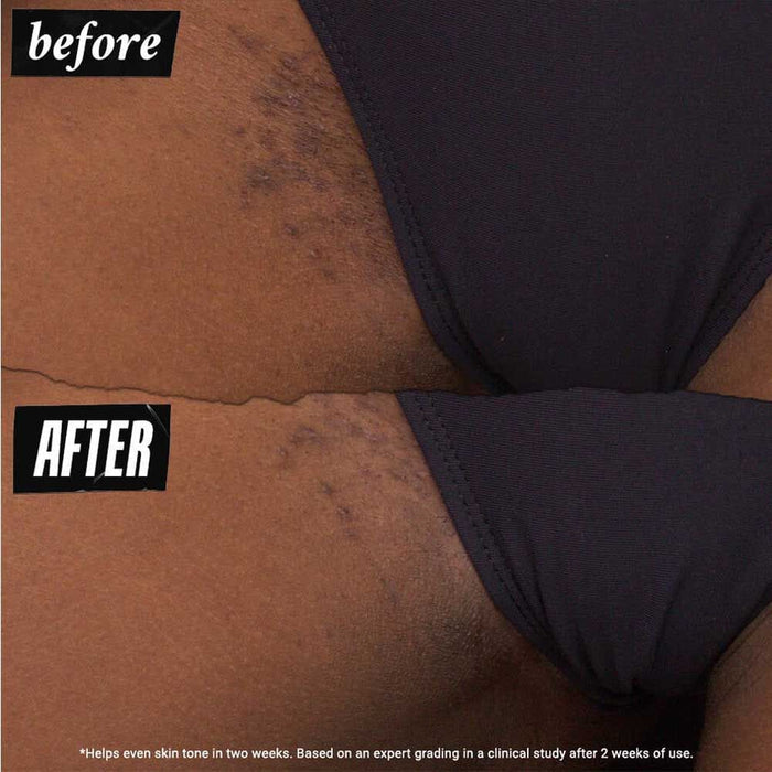 Kiehl's Ingrown Hair And Tone-Correcting Intimate Drops