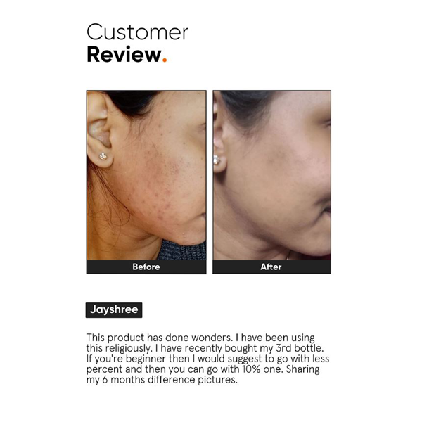 Minimalist 10% Niacinamide Serum 30ml
