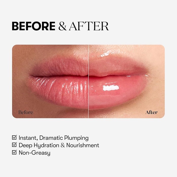 REEDLE SHOT LIP PLUMPER EXPERT - Balsam De Buze Cu Efect De Voluminizare - skinseen.ro