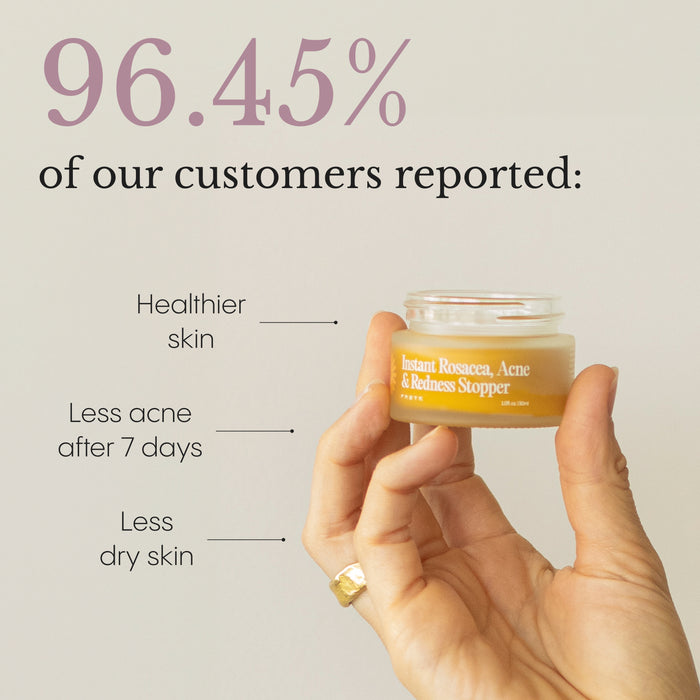 Frøya Organics Complete Acne System for Women clinical studies and scientifically backed results