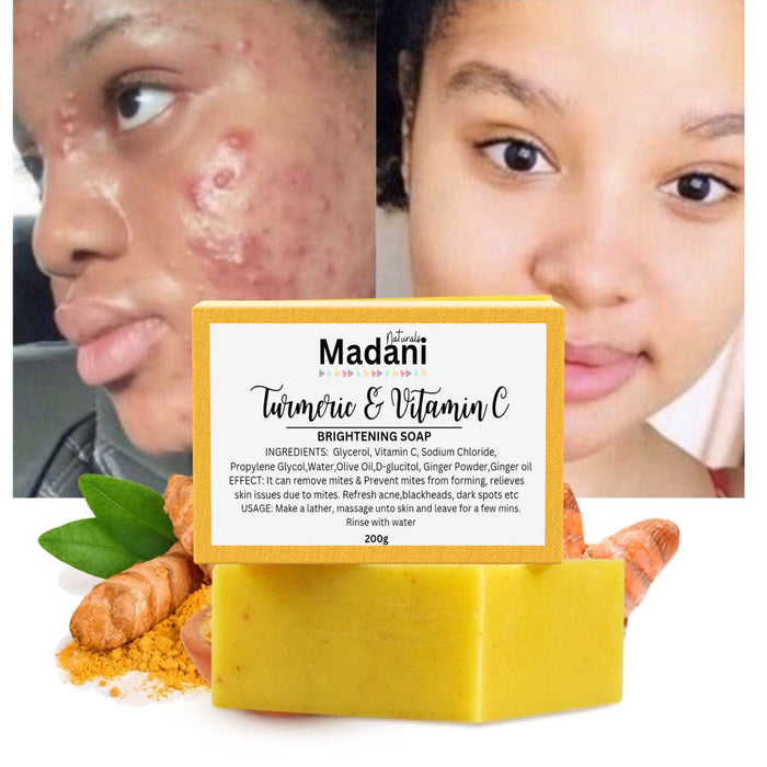 Turmeric & Vitamin C Brightening Bar