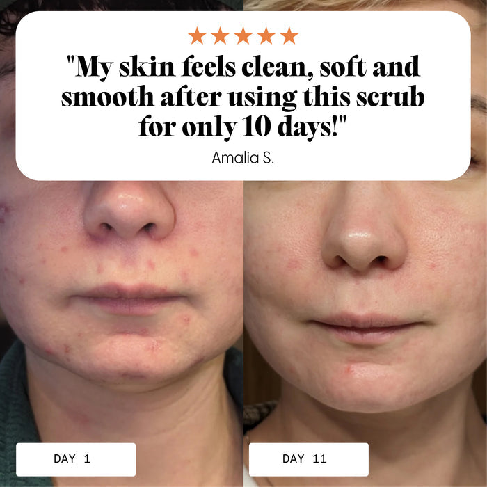 Frøya Organics Ultra Cleanse & Revive Face Scrub – organic face scrub by Frøya Organics