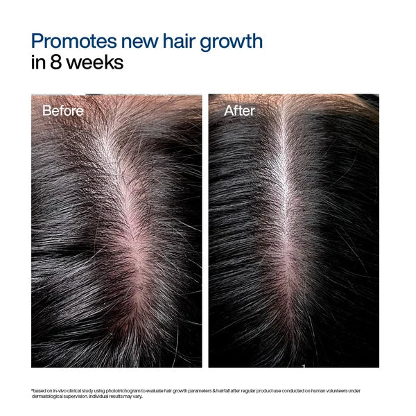 WishCare Hair Growth Serum Concentrate Roll On